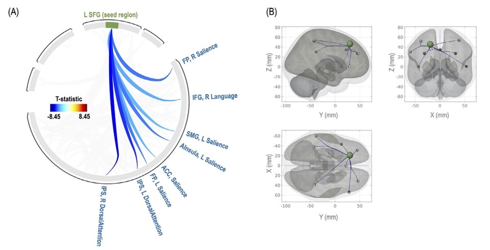 Hypothesis-driven neurological network guidance: research suggests that the superior frontal gyrus (SFG) involved in statistical learning is deeply related to other brain regions involved in downregulation.  It was also found that the stronger the network in the negative direction, the better the statistical learning.