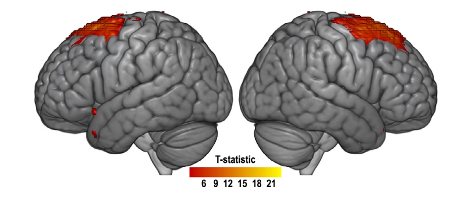 Data-driven neurological network map: When the neurological network was investigated with only data without any hypothesis, it was revealed that the neurological network centered on the epifrontal gyrus greatly contributes to statistical learning.