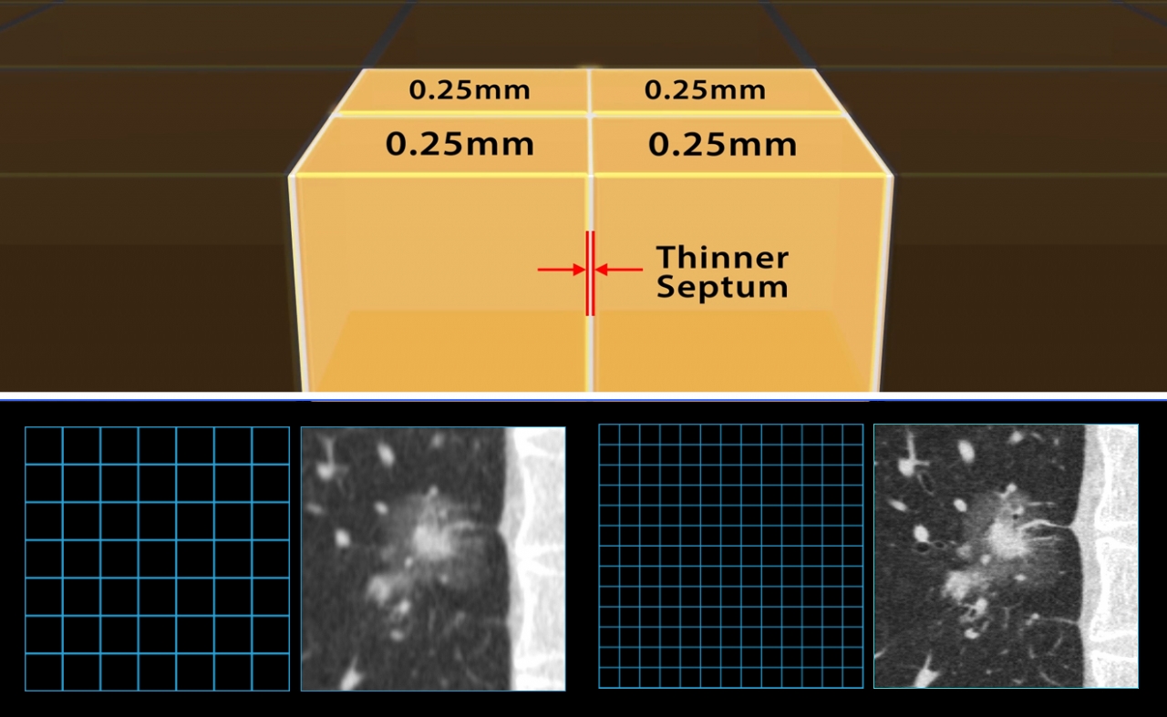 그림(위) 정밀 UHR 검출 시스템(0.25 mm x 160 행, 1792 채널) 개요, (아래)는 새로운 UHR 재구성 매트릭스 기존 CT(512ⅹ512), 새로운 UHR CT(1024ⅹ1024)