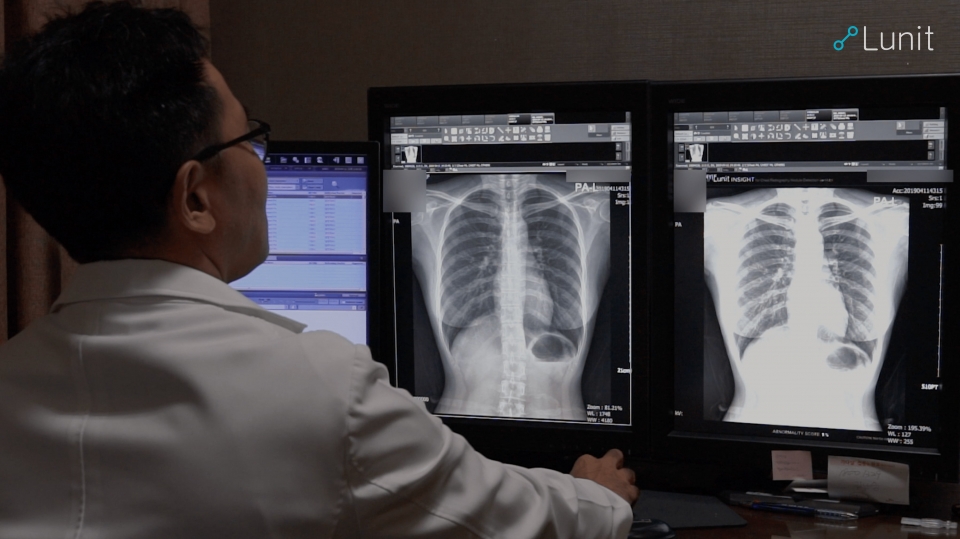 ‘루닛 인사이트 CXR’을 사용해 흉부 엑스레이를 분석하고 있다.