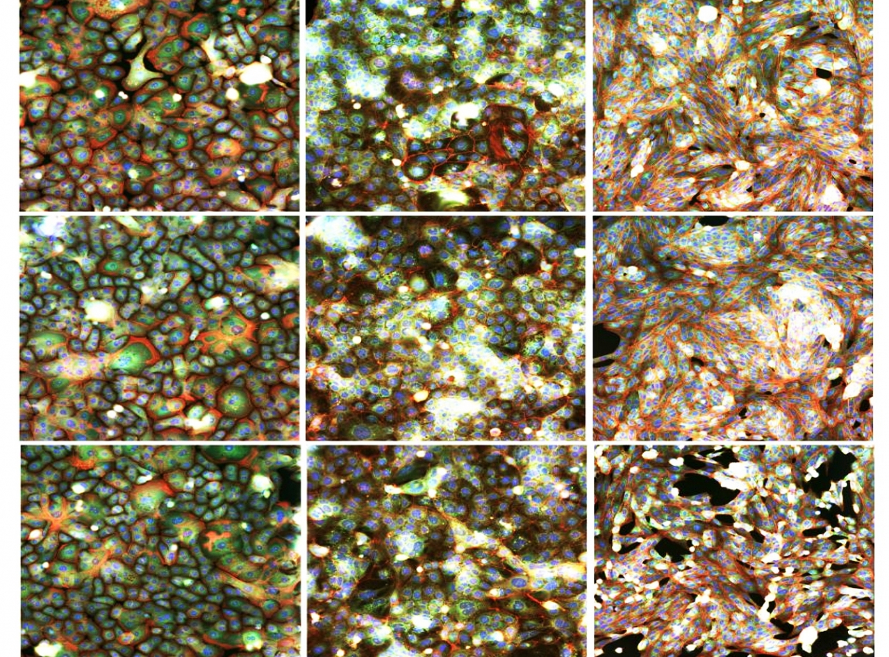 SARS-CoV-2로 처리된 추가 세포 유형 분석 이미지(사진:논문 캡처)