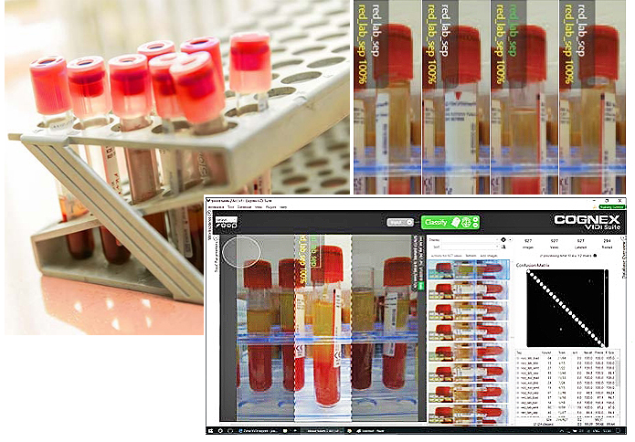 딥러닝 기반 이미지 분석으로 진단시약 및 키트 검사를 수행하는 코그넥스 ‘비전프로 비디(VisionPro ViDi)’시연 화면(사진:코그넥스)