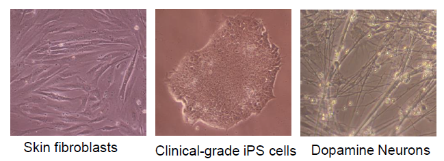 피부세포, 유도만능 줄기세포, 도파민 뉴런의 사진