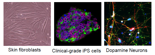 피부세포, 유도만능 줄기세포, 도파민 뉴런의 사진