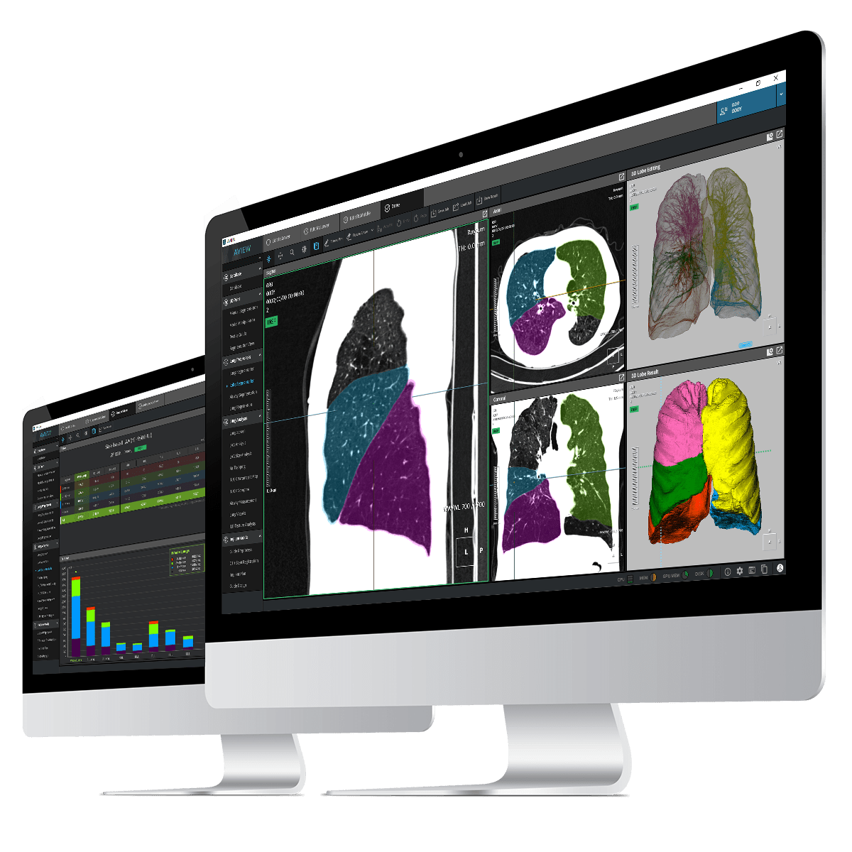 사진은 흉부 CT 영상을 이용한 COPD의 정량적 이미지 바이오마커를 위한 소프트웨어 AVIEW COPDTM의 시연 이미지(사진:코어라인소프트)