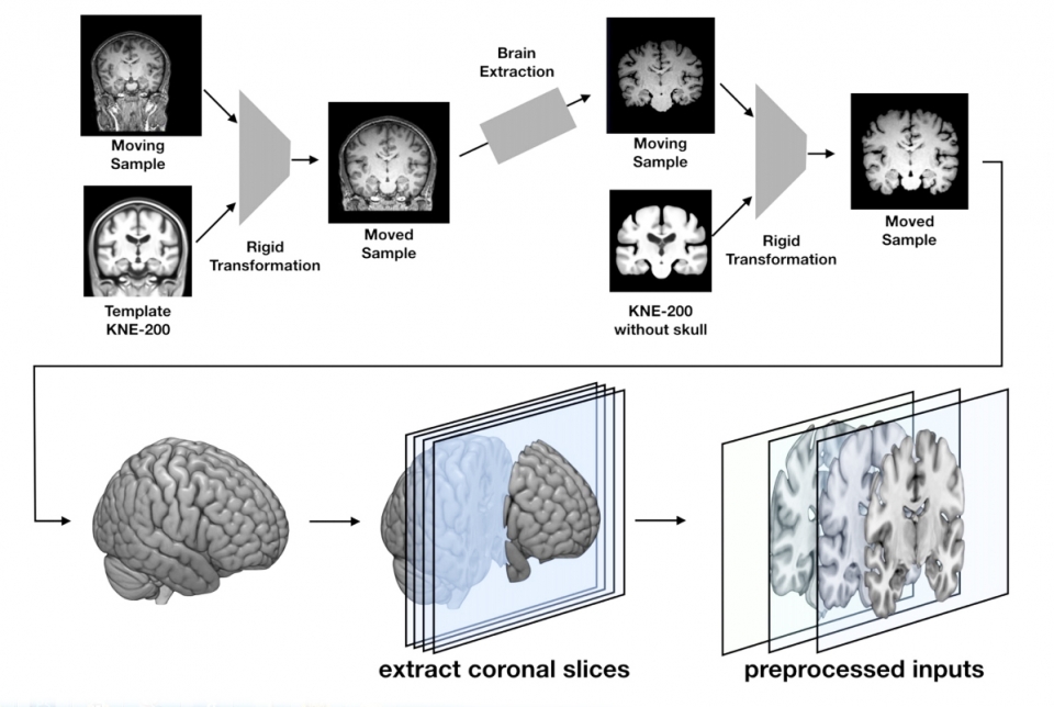 완전한 3D 뇌 이미지에서 피사체 이미지를 출력하는 과정(사진:논문캡처)