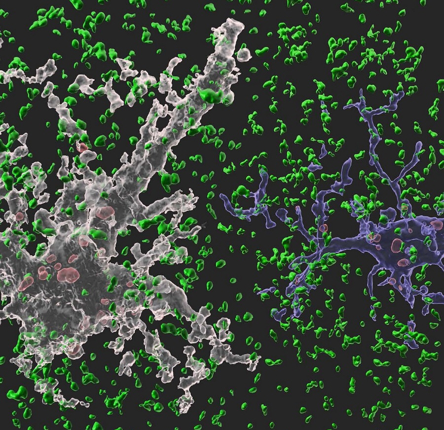 네이쳐(Nature)에 수록된 이번 연구 이미지. 흰색 별아교세포와 파란색 미세아교세포가 시냅스(정상 시냅스는 녹색, 신경교세포에 의해 제거된 시냅스는 붉은색)를 제거하고 있는 모습