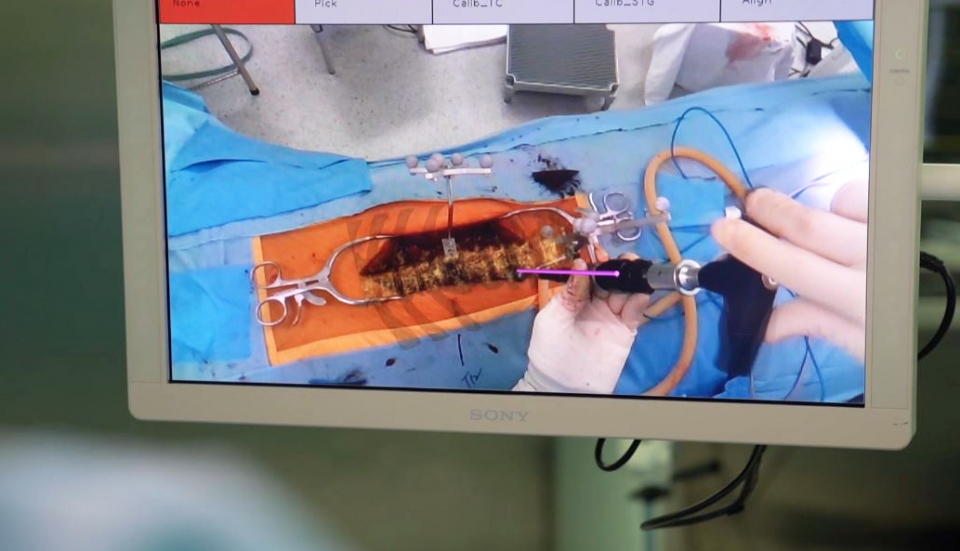 오버레이 그래픽을 이용해 척추경 나사를 삽입하는 모습