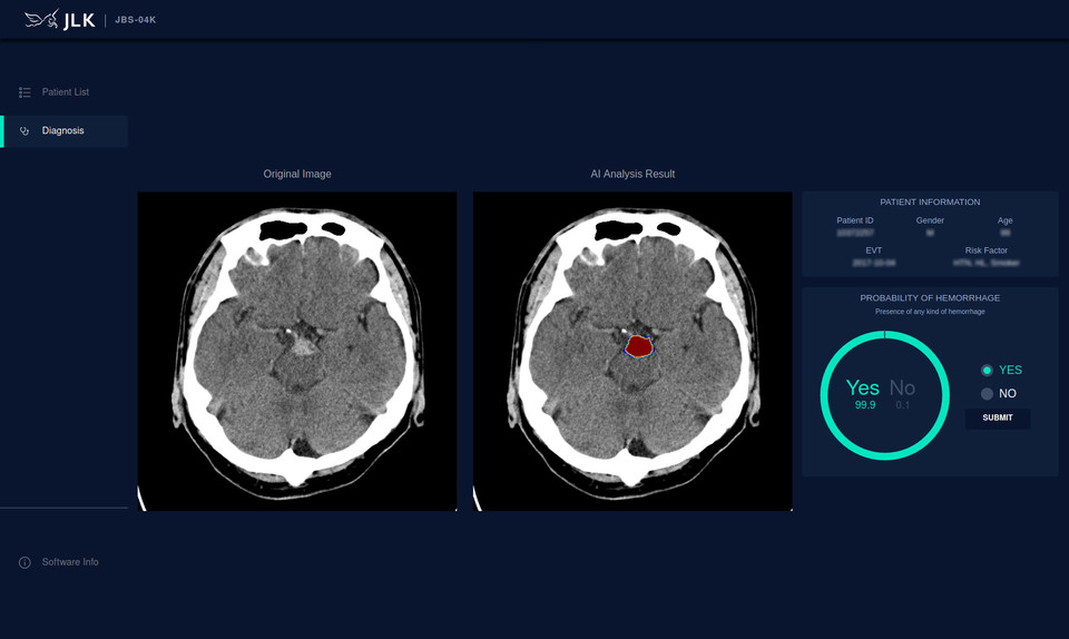 제이엘케이의 인공지능 뇌출혈 분석 솔루션 ‘JBS-04K’ 시연 이미지