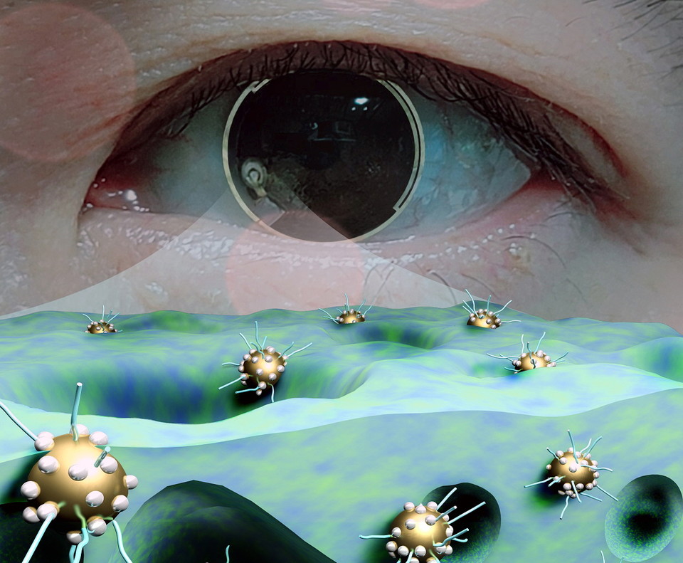 바이메탈 나노촉매 및 당산화효소 충진 나노다공성 하이드로젤을 이용한 연속 당뇨 모니터링 스마트 콘택트렌즈에 대한 이미지