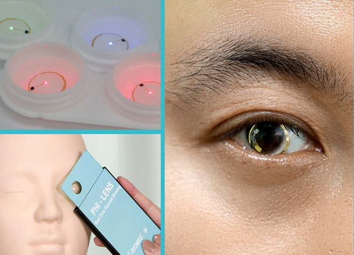 연구자 임상시험에서 착용한 무선 구동 스마트 콘택트렌즈 이미지