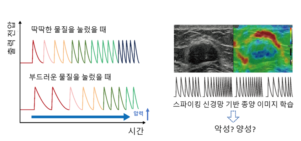 왼쪽) 누르는 물질의 딱딱한 정도에 따른 인공 촉각 뉴런 소자의 스파이크 신호 패턴 예시, (오른쪽) 생성된 스파이크 정보를 바탕으로 유방암 탄성 초음파 이미지를 학습하여 종양의 악성/양성을 판단하는 예시. 빨간색은 부드러운 영역을, 파란색은 딱딱한 영역을 나타냄