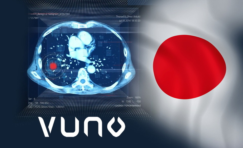 VUNO Med®-Lung CT AI™ 일본 보험급여 대상으로 인정