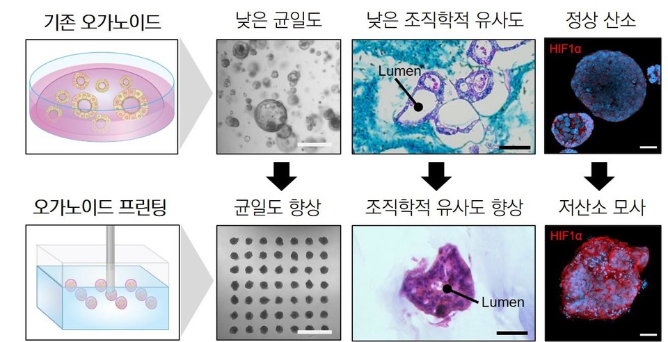 “암 조직 자란 모양만 봐도 AI가 예후 예측”... UNIST·서울아산병원, 암 성장 환경 모사 기술 개발