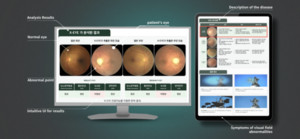 파이헬스케어, 'AI EXPO KOREA 2026'서 임상 현장 중심 의료 AI 솔루션 DO... - 뉴스 썸네일 이미지