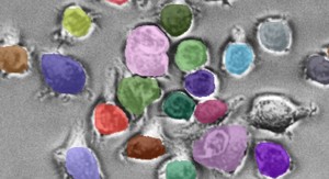 “세포 식별도 AI가 한다”…칼텍, 범용 생물 이미지 분석 모델 ‘셀SAM’ 오픈소스로 공개