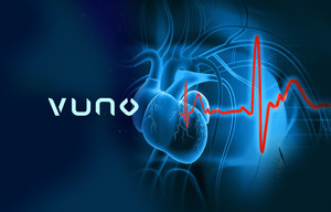 뷰노, ‘심부전 선별 AI’ 고도화 연구서 높은 성능 개선…AUROC 0.956 달성